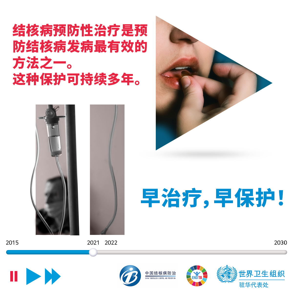 World TB Day 2021 World TB Day 2021